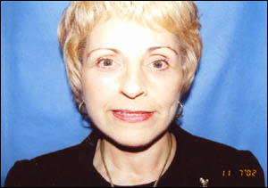 Facelift Before & After Patient #2447