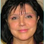 Facelift Before & After Patient #864