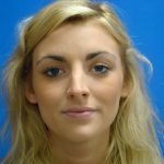 Revision Rhinoplasty Before & After Patient #321