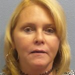 Facelift Before & After Patient #942