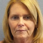 Facelift Before & After Patient #942
