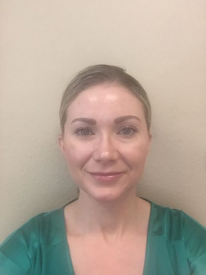 Filler Before & After Patient #2243