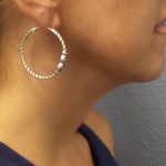 Liposuction of the Neck Before & After Patient #413