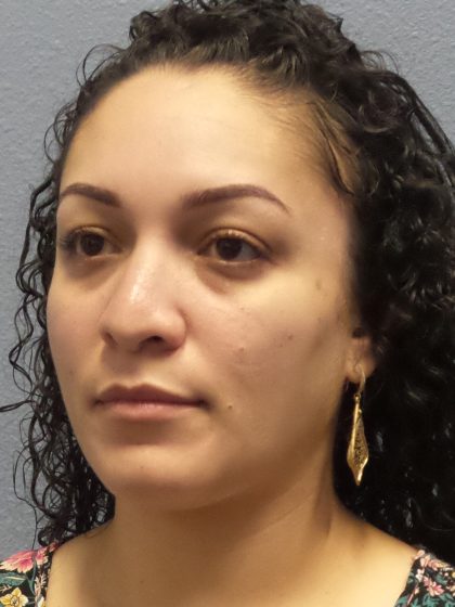 Revision Rhinoplasty Before & After Patient #257