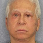 Facelift Before & After Patient #11809