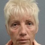 Facelift Before & After Patient #11736