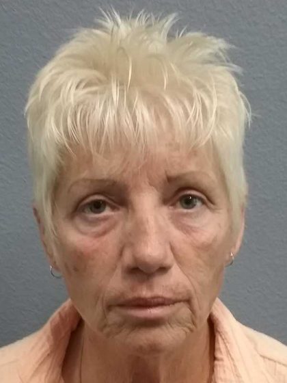 Facelift Before & After Patient #11736