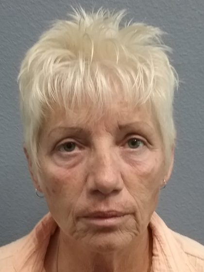 Facelift Before & After Patient #7521