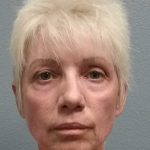 Facelift Before & After Patient #11736