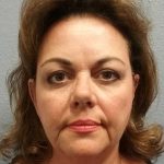 Facelift Before & After Patient #11914
