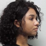 Rhinoplasty Before & After Patient #10165