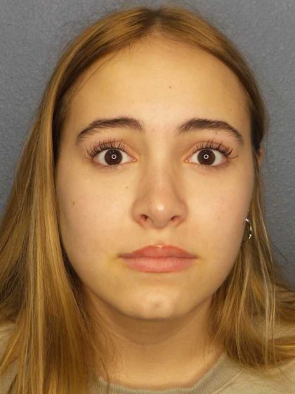 Rhinoplasty Before & After Patient #9794