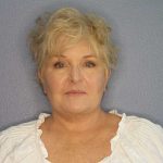 Facelift Before & After Patient #7546