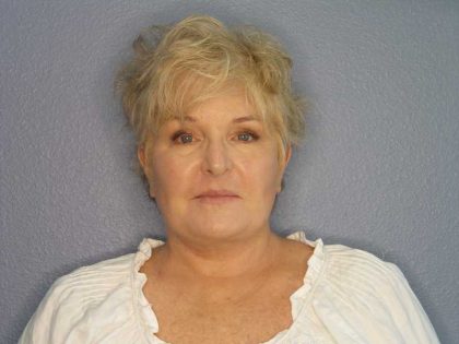 Facelift Before & After Patient #7546