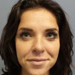 Rhinoplasty Before & After Patient #9969