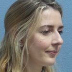 Rhinoplasty Before & After Patient #10018
