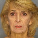 Facelift Before & After Patient #7554