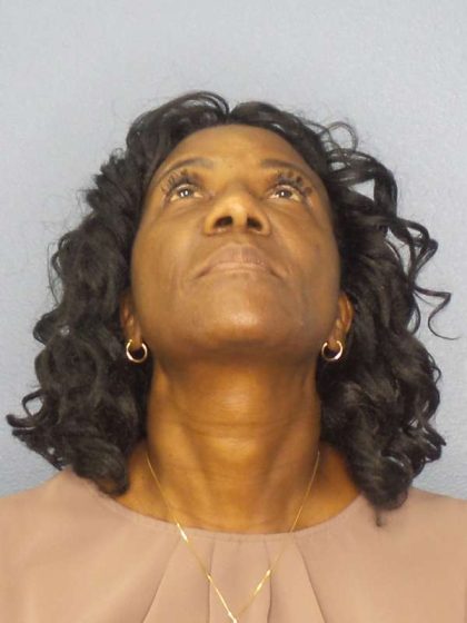 Rhinoplasty Before & After Patient #9893
