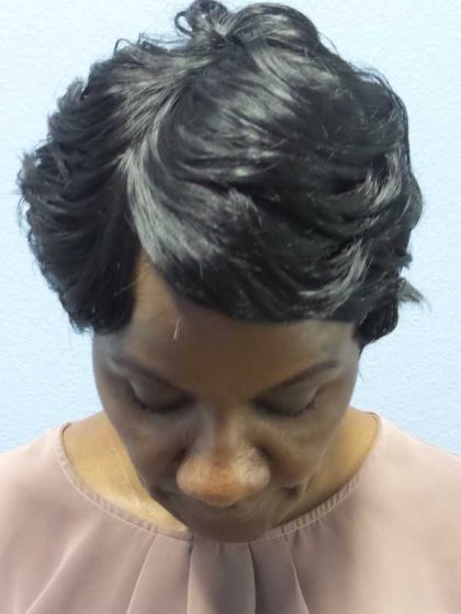 Rhinoplasty Before & After Patient #9893