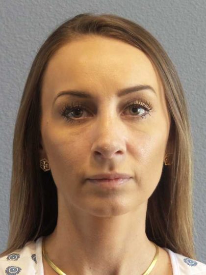 Rhinoplasty Before & After Patient #9823