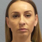 Rhinoplasty Before & After Patient #9823