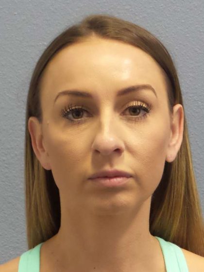Rhinoplasty Before & After Patient #9823