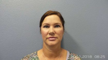 Filler Before & After Patient #7596