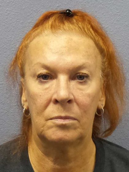 Facelift Before & After Patient #11767