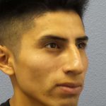 Rhinoplasty Before & After Patient #9929