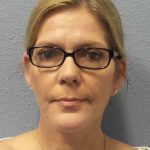 Facelift Before & After Patient #7572
