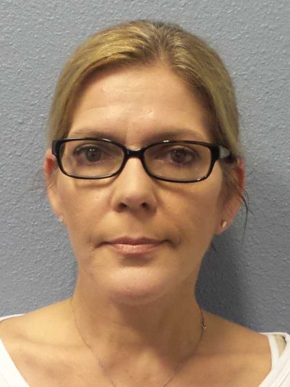 Facelift Before & After Patient #7572