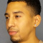 Rhinoplasty Before & After Patient #12373