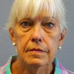Facelift Before & After Patient #11892