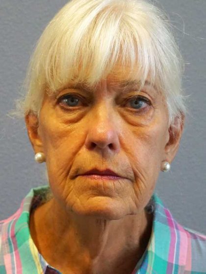 Facelift Before & After Patient #11892