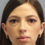 Rhinoplasty Before & After Patient #12395