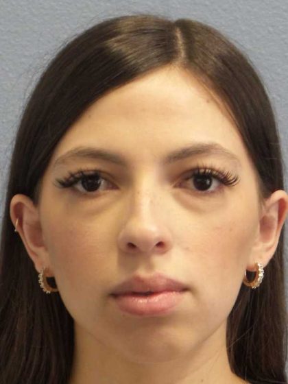 Rhinoplasty Before & After Patient #12395